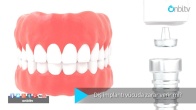 Diş implantı vücuda zarar verir mi?