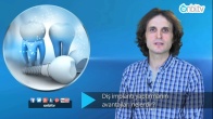 Diş implantı yaptırmanın avantajları nelerdir?
