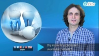 Diş implantı yaptırmanın avantajları nelerdir?