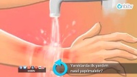 Yanıklarda ilk yardım nasıl yapılmalıdır?
