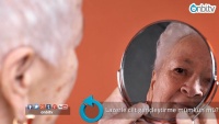 Lazerle cilt gençleştirme mümkün mü?