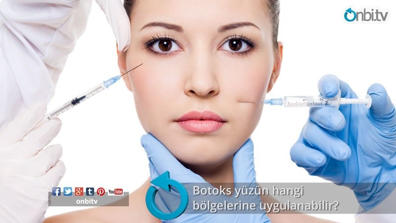 Botoks yüzün hangi bölgelerine uygulanabilir?