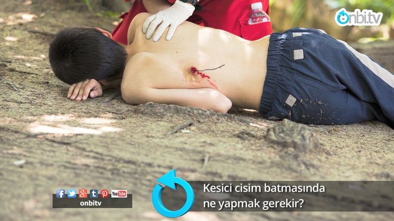 Kesici cisim batmasında ne yapmak gerekir?