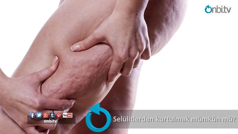 Selülitlerden kurtulmak mümkün mü?