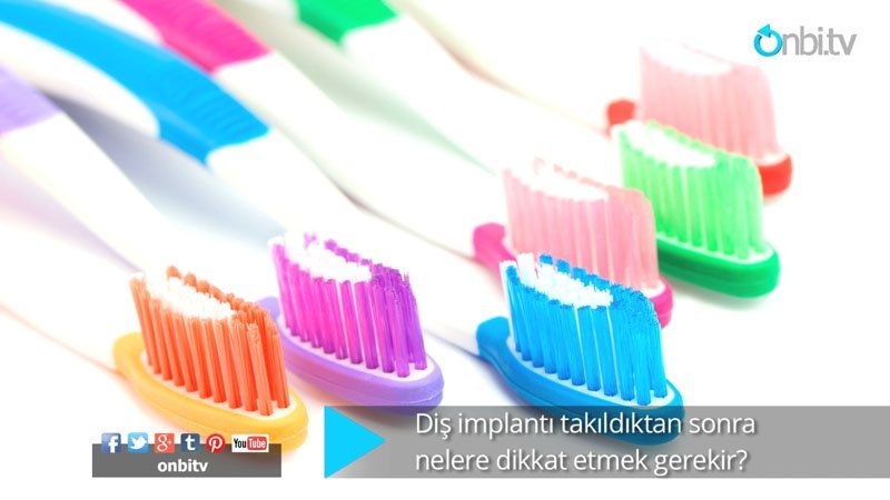 Diş implantı takıldıktan sonra nelere dikkat etmek gerekir?