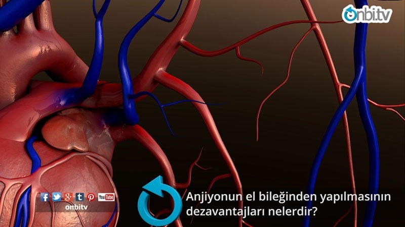 Anjiyonun el bileğinden yapılmasının dezavantajları nelerdir?