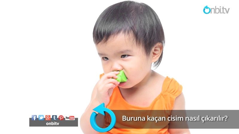 Buruna kaçan cisim nasıl çıkarılır?