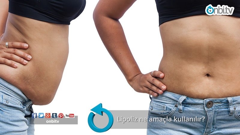 Lipoliz ne amaçla kullanılır?